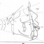 Cephalometric analysis