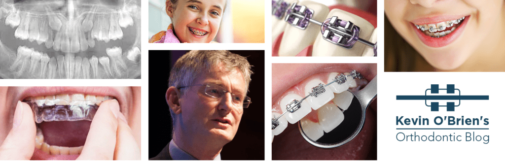 Orthodontic blog