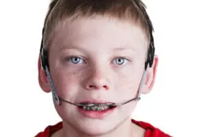 Boy,With,Braces,And,Headgear - Kevin O'Brien's Orthodontic Blog headgear