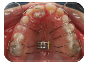 Ortodonti10