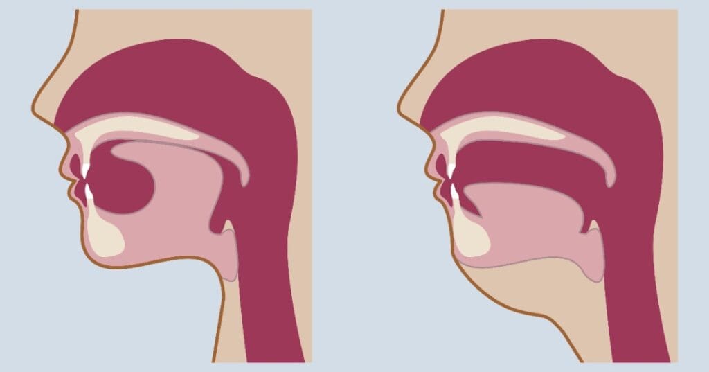 Mewing - Kevin O'Brien's Orthodontic Blog Mewing